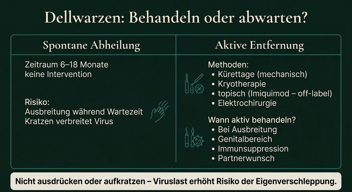 Entscheidungsinfografik 'Dellwarzen: Behandeln oder abwarten?': Links Spontane Abheilung (6–18 Monate, Risikohinweis); rechts Aktive Entfernung (Kürettage, Kryotherapie, Imiquimod, Elektrochirurgie) + Wann-Indikationen