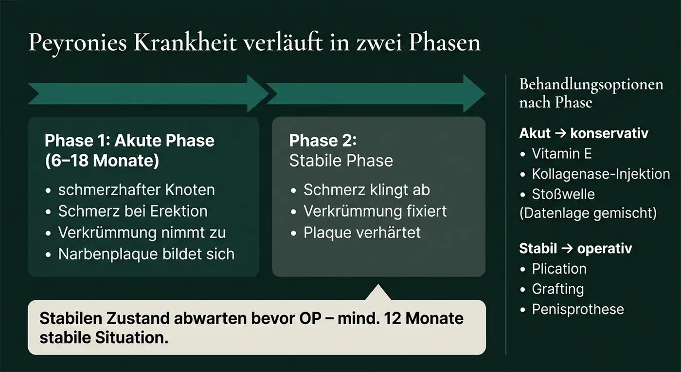 Zweiphasen-Diagramm Peyronie-Krankheit: Phase 1 Akut (6–18 Monate: Knoten, Schmerz, Narbenplaque); Phase 2 Stabil (Verkrümmung fixiert); Behandlungsoptionen je Phase (konservativ/operativ)